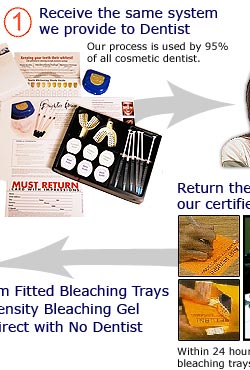 Teeth Whitening Process