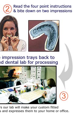 Teeth Whitening Process