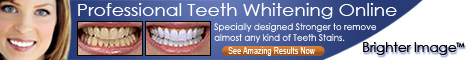 Professional Teeth Whitening - 7 Shades Whiter in 1 Day